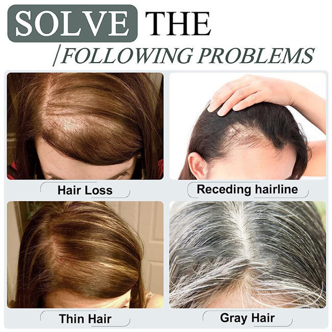 Cuticle Aligned Ladies Hair Topper Toupee Womens Hairpieces Replacement 9