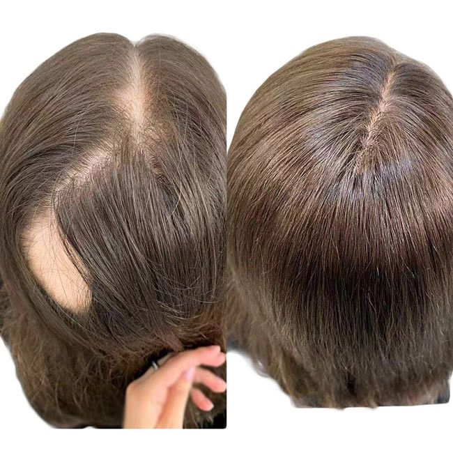 150g Middle Part Female Women'S Toupee Wigs Hair Replacement 6